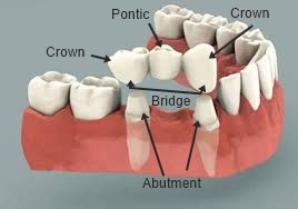 Cosmetic Dentist In Sydney: Always Choose