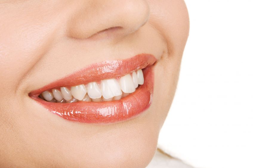 Dental Implants In Castle Hill: Benefits