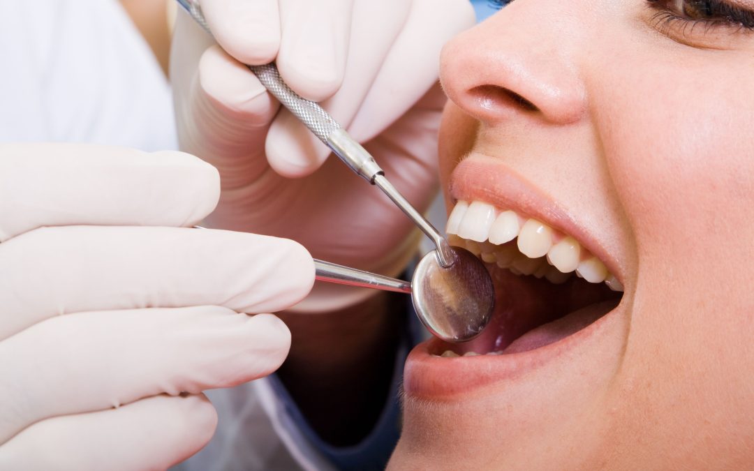 The Benefits of Choosing Veneers in the Albert-Eden Area for Lasting Smile Enhancements